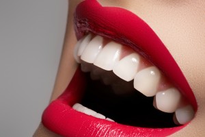 Teeth Whitening