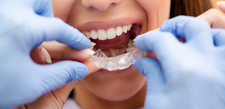 woman being fit for invisilign tooth trays