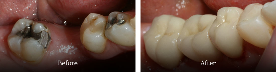 before and after treatment