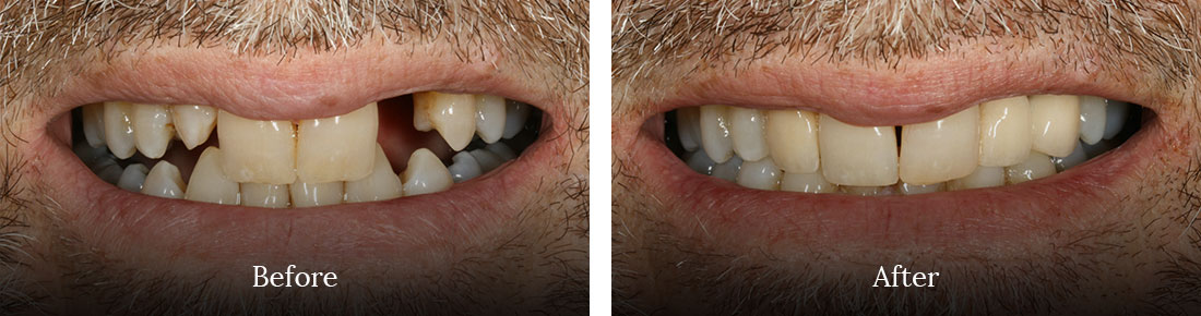 before and after treatment