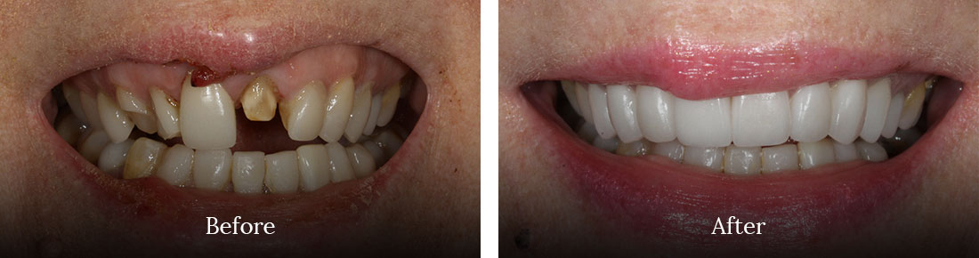 before and after shore dental treatment