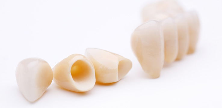 dental crowns and a dental bridge on white background