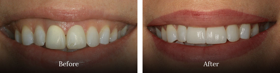 before and after treatment