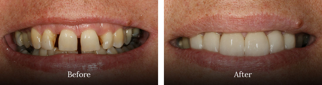 before and after treatment