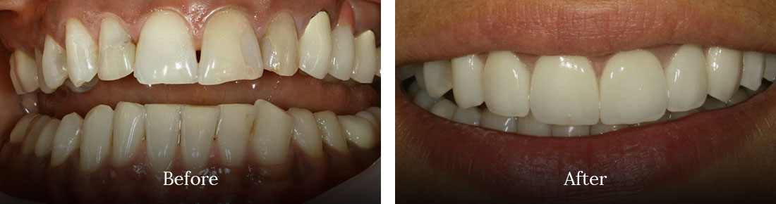 before and after treatment