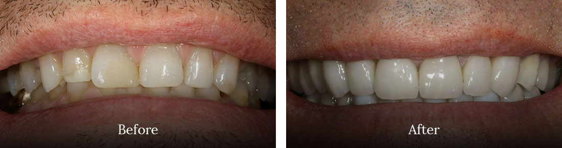 before and after treatment