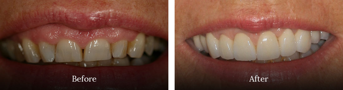 before and after treatment