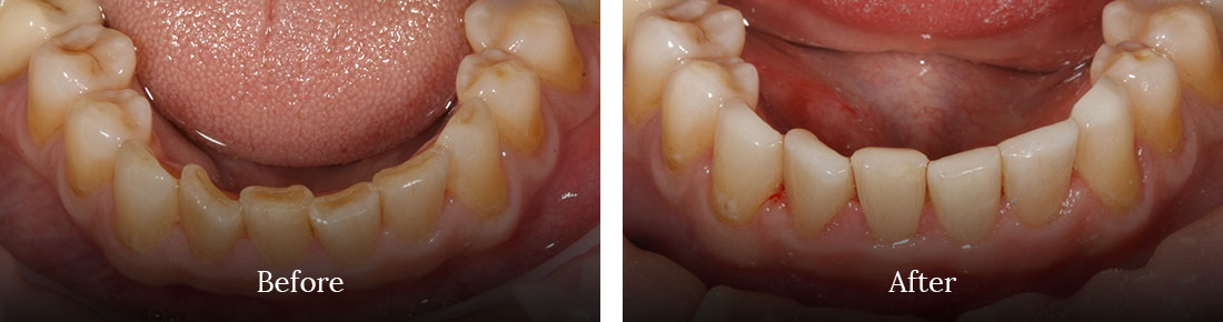 before and after treatment