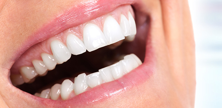 a woman smiling showing her gums when she smiles