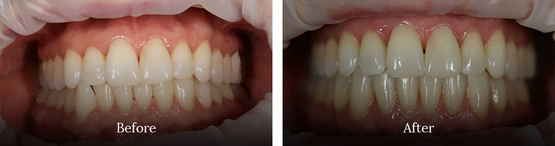 before and after treatment