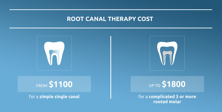 cost of root canal therapy