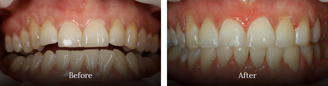 before and after treatment