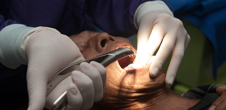 an elderly man undergoing surgery with sergical gloves and tools being used in his mouth.