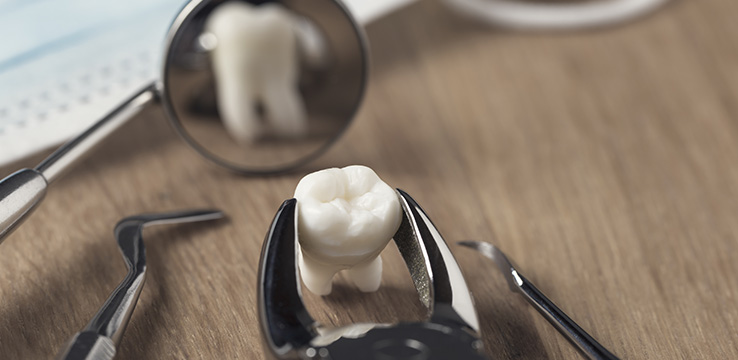 replacement tooth being held by dental tools and reflecting in a dental mirror