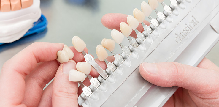 lab worker trying to match a crown with the proper shade on a chart of sample teeth