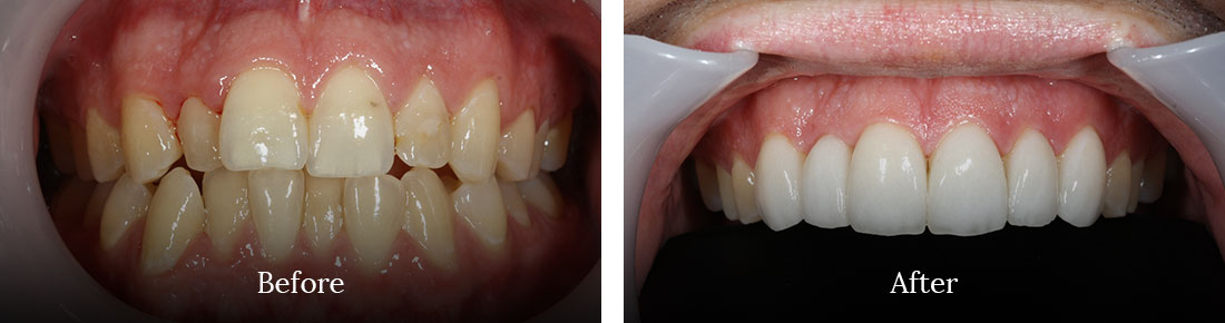 before and after treatment