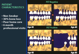 tooth and gum graphs