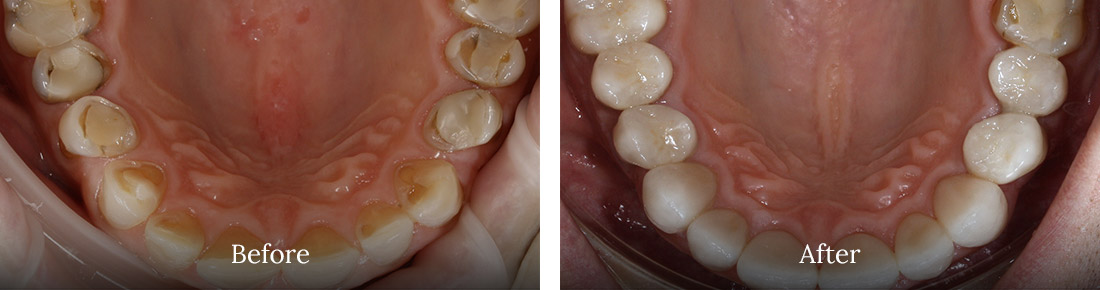 before and after treatment