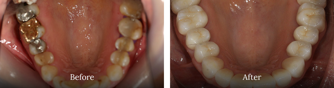 before and after treatment