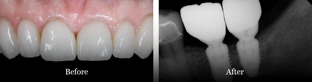 before and after treatment