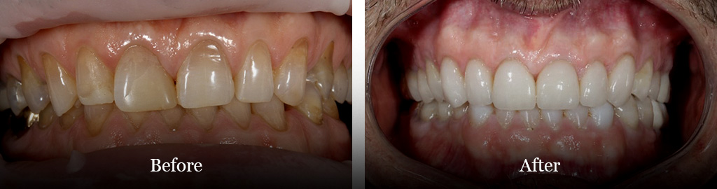 before and after treatment