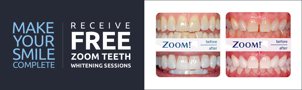 special offer with before and after of teeth that have been whitened