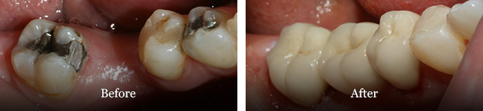 before and after treatment