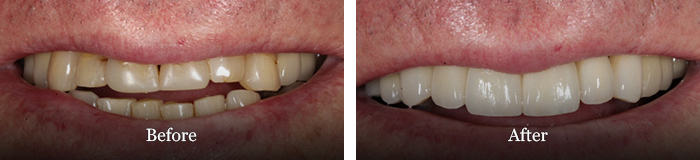 before and after treatment