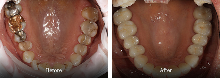 before and after treatment