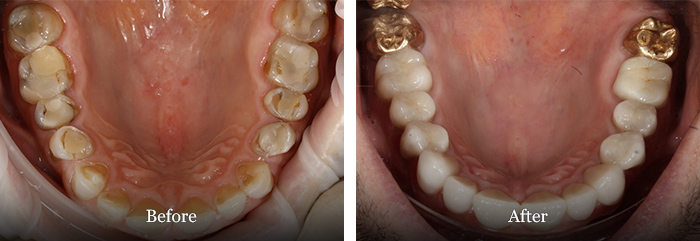 before and after treatment