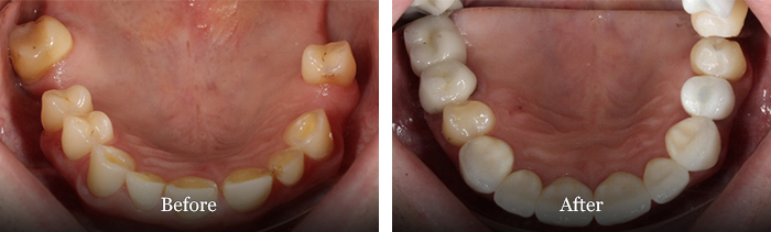 before and after treatment