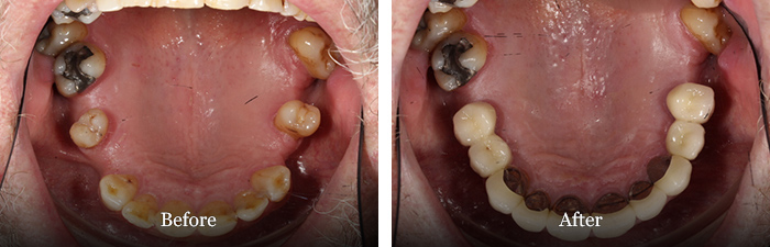 before and after treatment