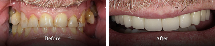 before and after treatment