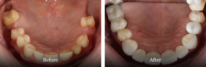 before and after treatment