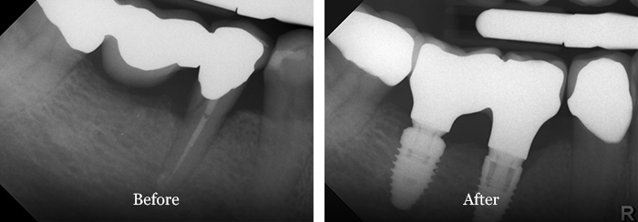 before and after treatment