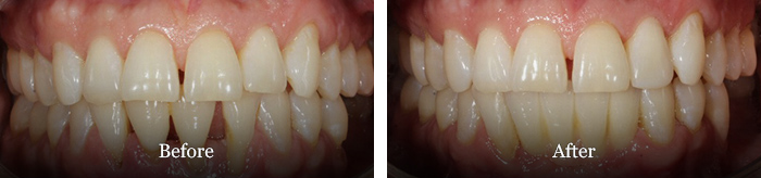 before and after treatment