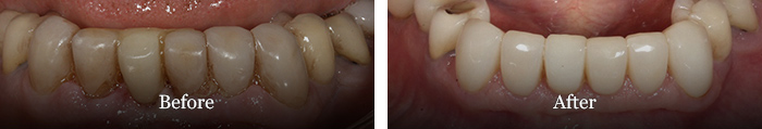 before and after treatment