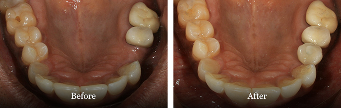 before and after treatment