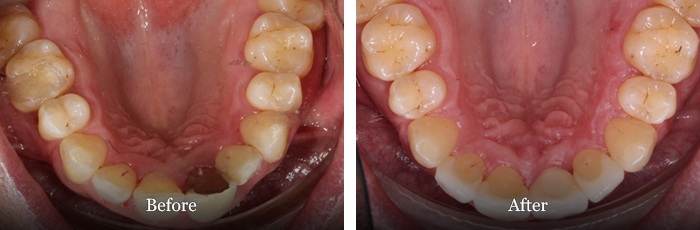 before and after treatment