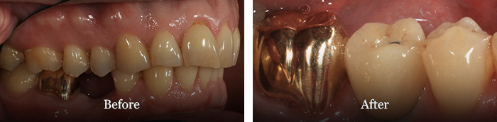 before and after treatment