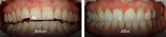 before and after treatment