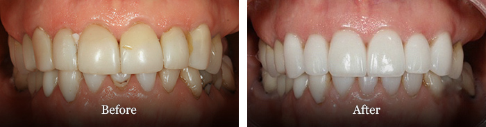 before and after treatment