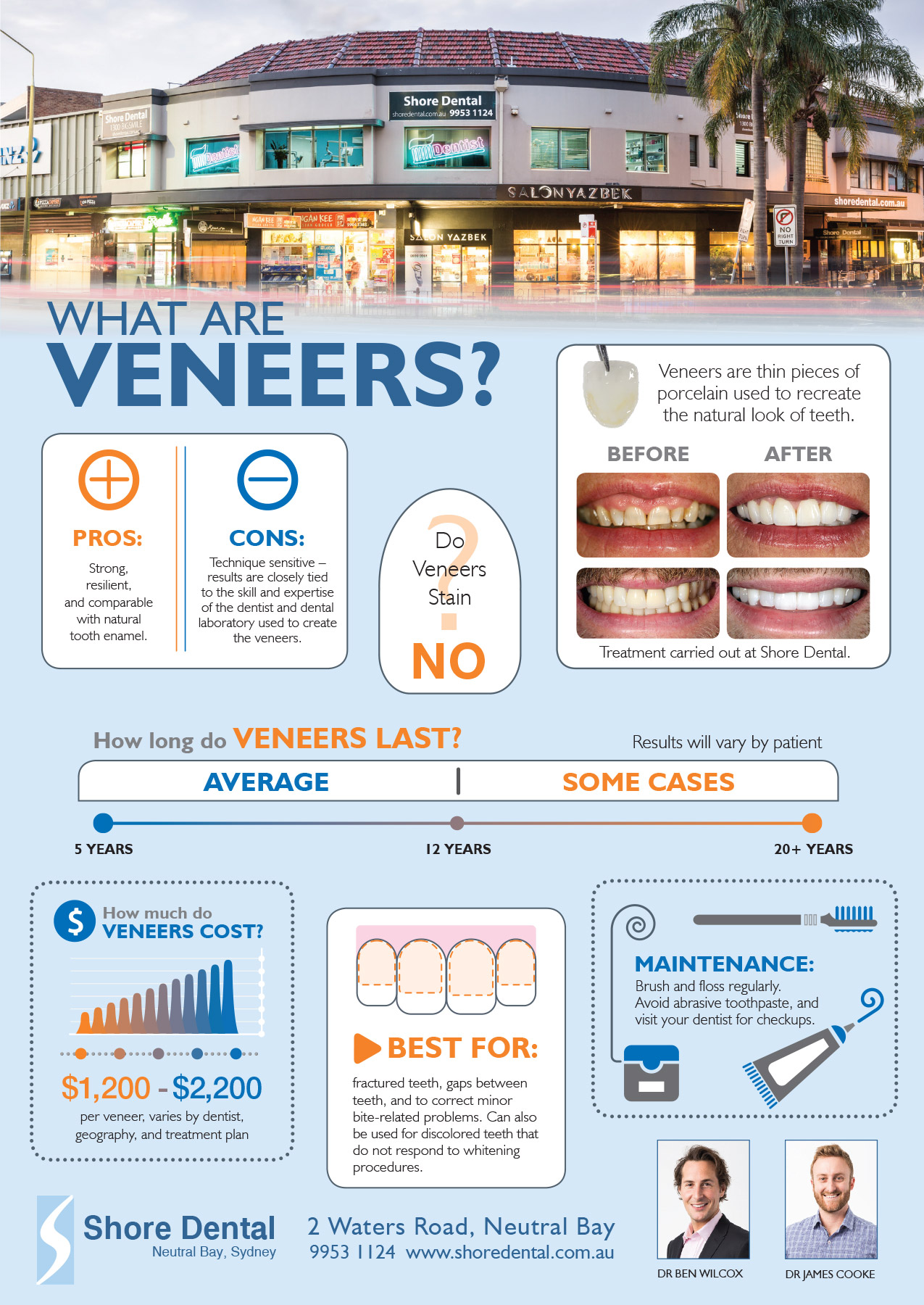 what are dental veneers infographic